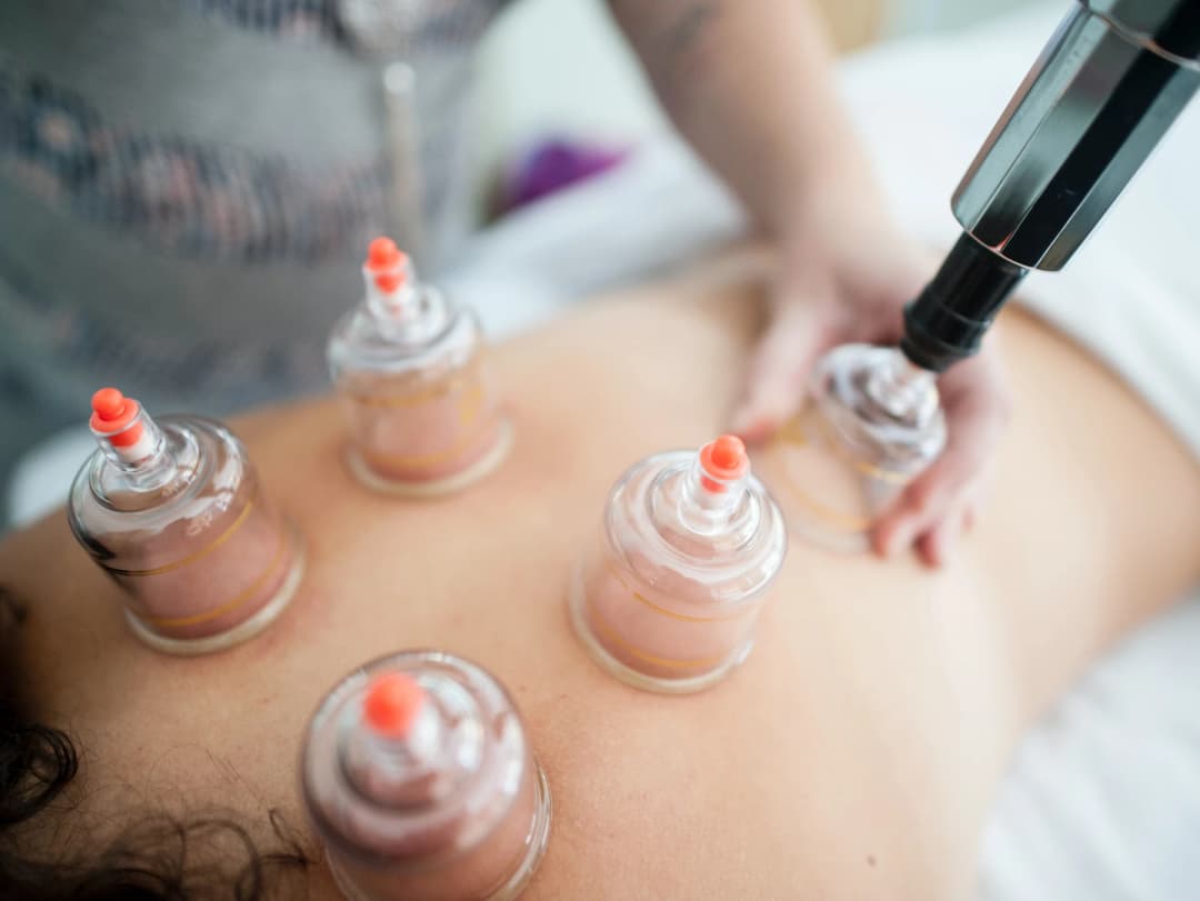 Stress and Hijama